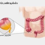 High blood pressure/உயர் குருதி அழுத்தம் என்றால் என்ன?? விளக்கம்