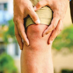Arthritis>>மூட்டுவலி (கீல்வாதம்)